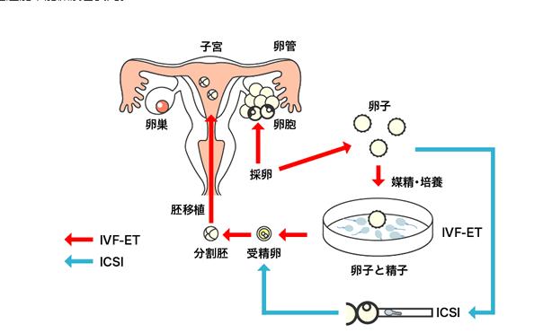 上海试管供卵流程【上海试管供卵流程解析及相关注意事项】
